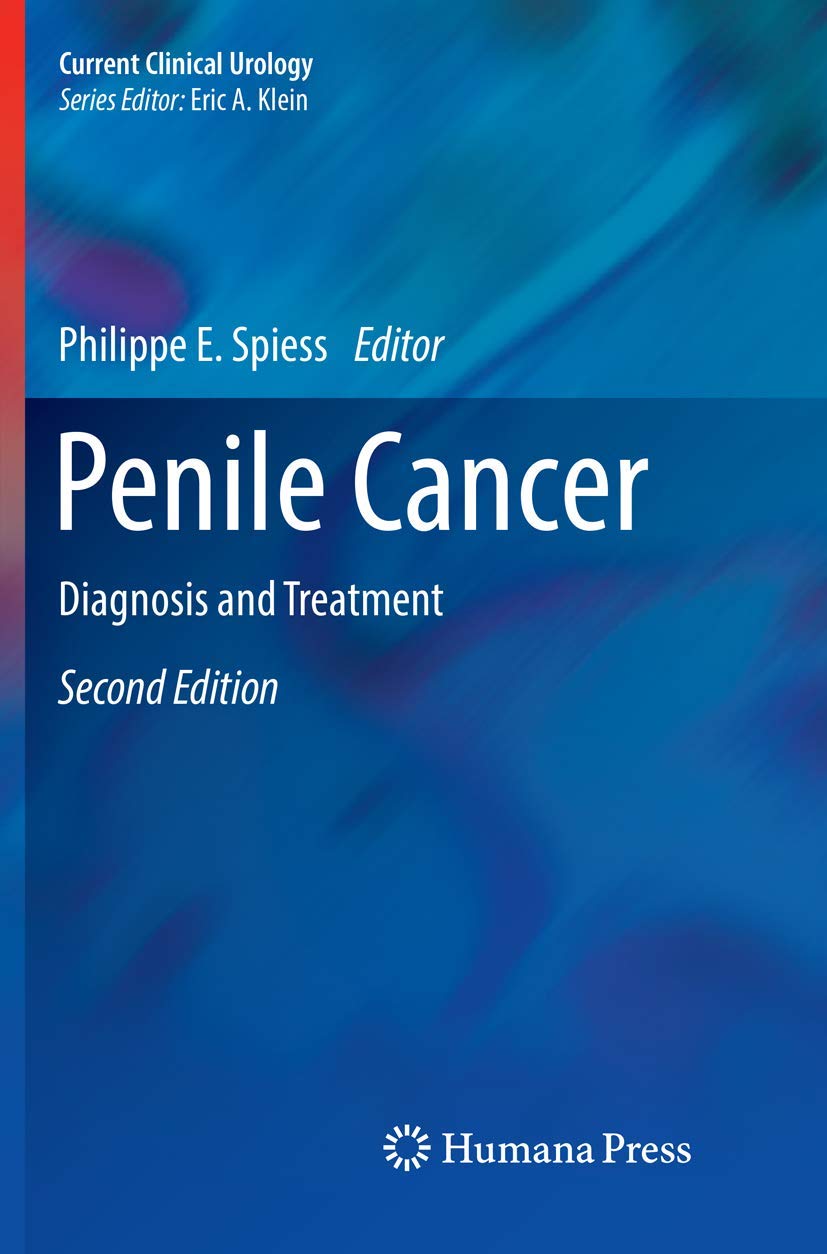 Penile Cancer: Diagnosis and Treatment - Essential Clinical Guide