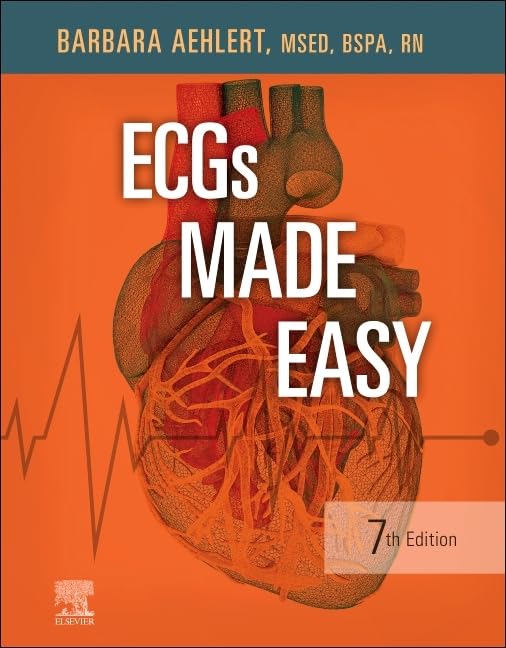 ECGs Made Easy: A Comprehensive Guide for Healthcare Professionals