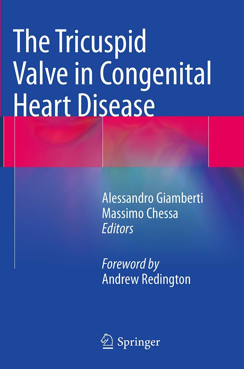 The Tricuspid Valve in Congenital Heart Disease: A Comprehensive Guide