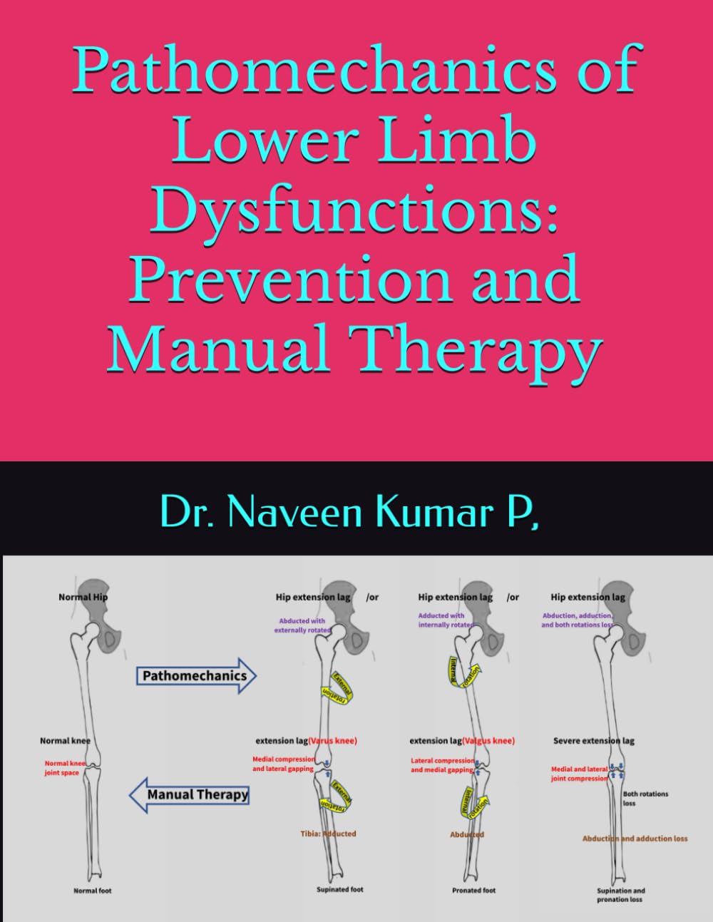 Lower Limb Dysfunction Prevention and Manual Therapy Techniques
