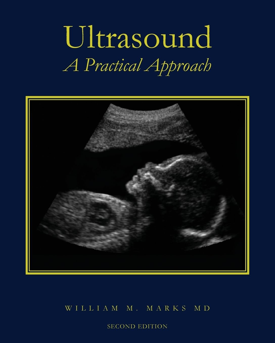Ultrasound: A Practical Approach by William M. Marks MD