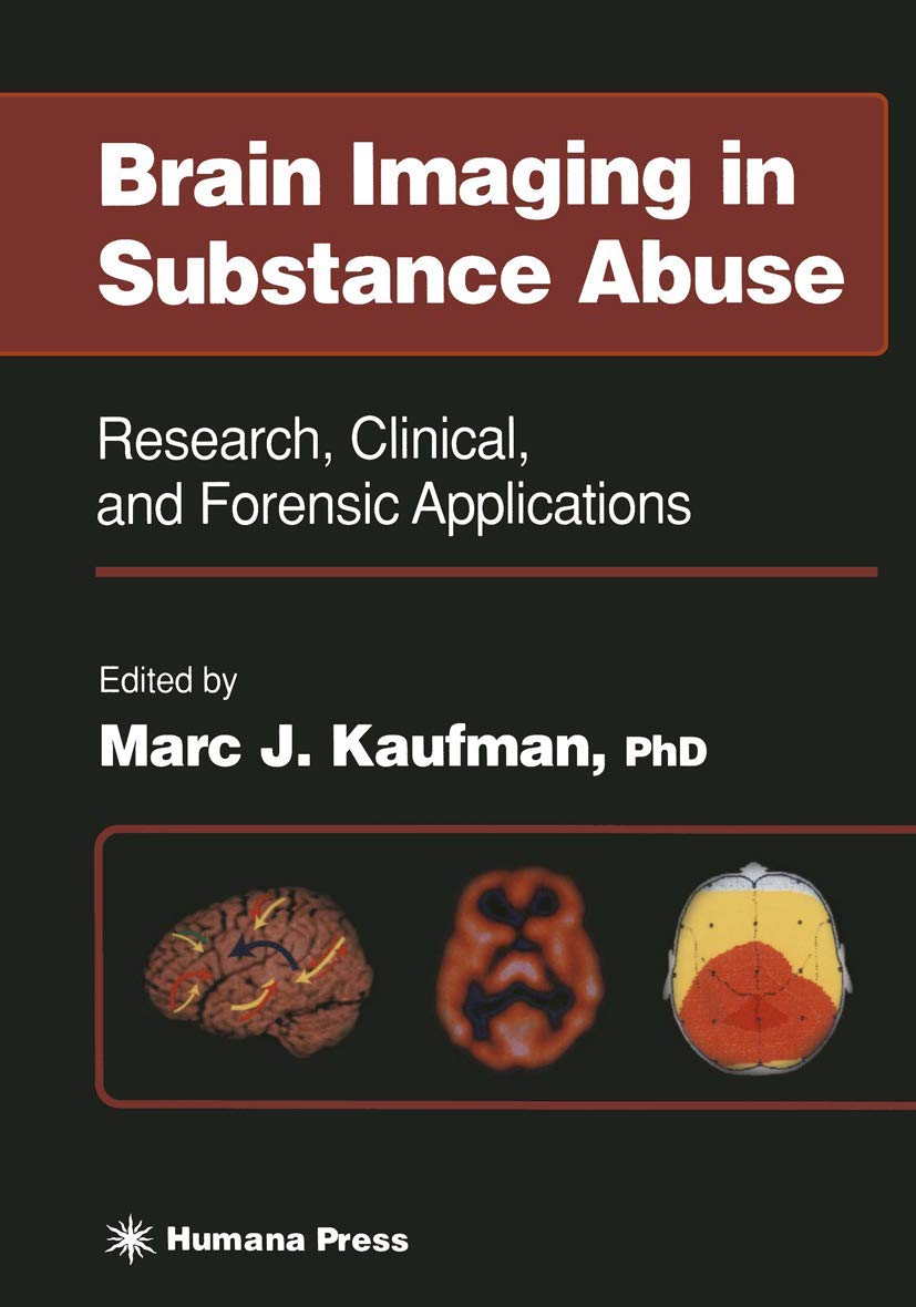 Brain Imaging in Substance Abuse: Research and Clinical Applications