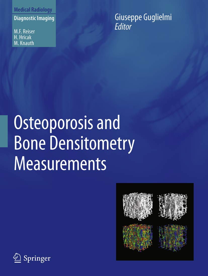 Osteoporosis and Bone Densitometry Measurements for Accurate Diagnosis