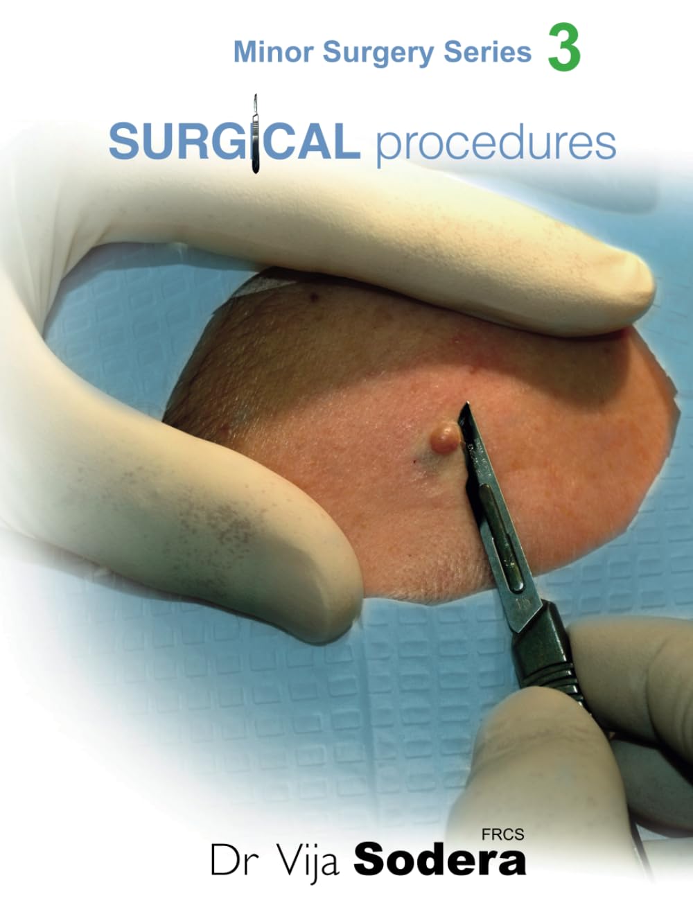 Surgical Procedures Guide for Minor Surgery Enthusiasts