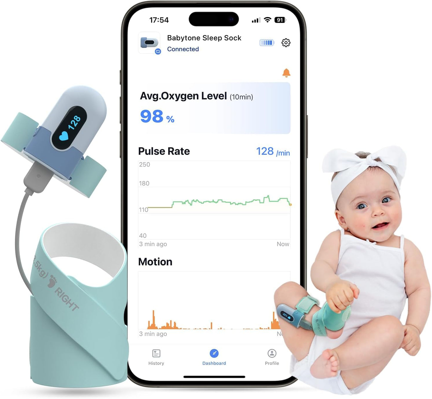 Babytone Baby Sleep Sock for Monitoring O2, Pulse Rate & Movement