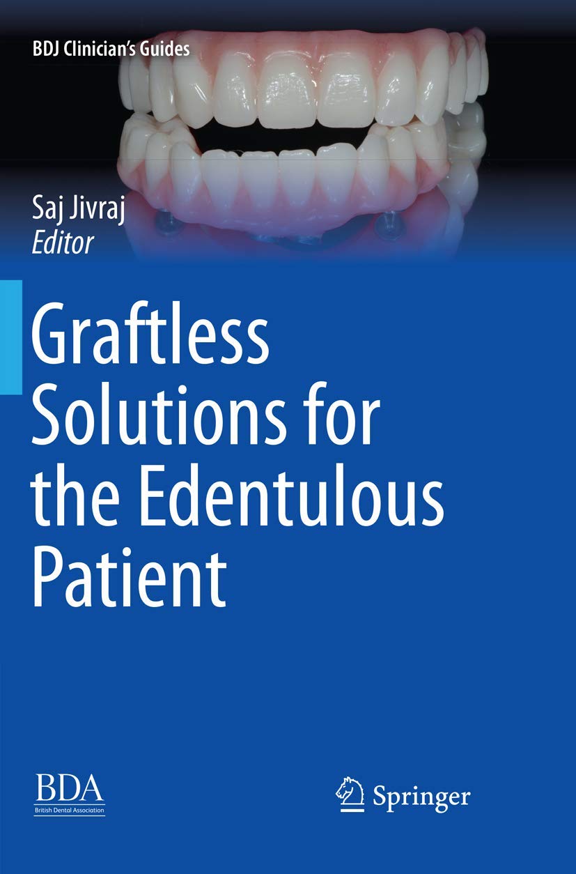 Graftless Solutions for the Edentulous Patient - BDJ Clinicians Guides