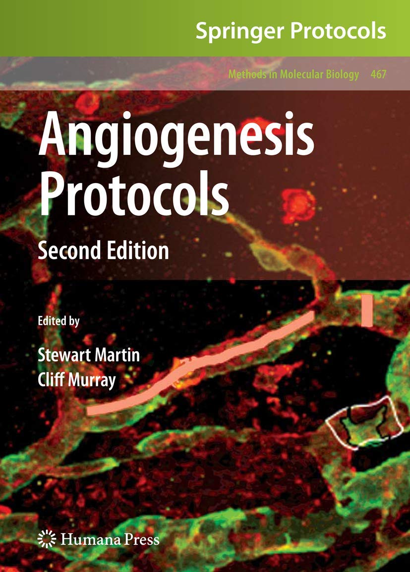 Angiogenesis Protocols for Advanced Molecular Biology Techniques