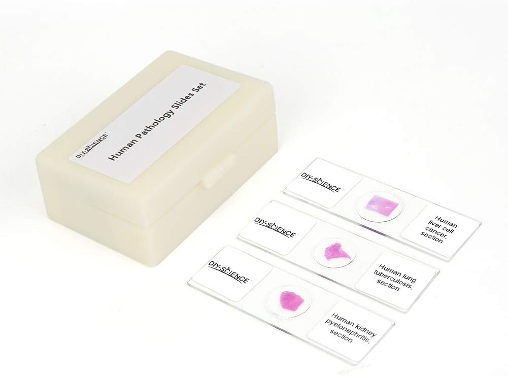Prepared Human Pathology Microscope Slide Set for Students