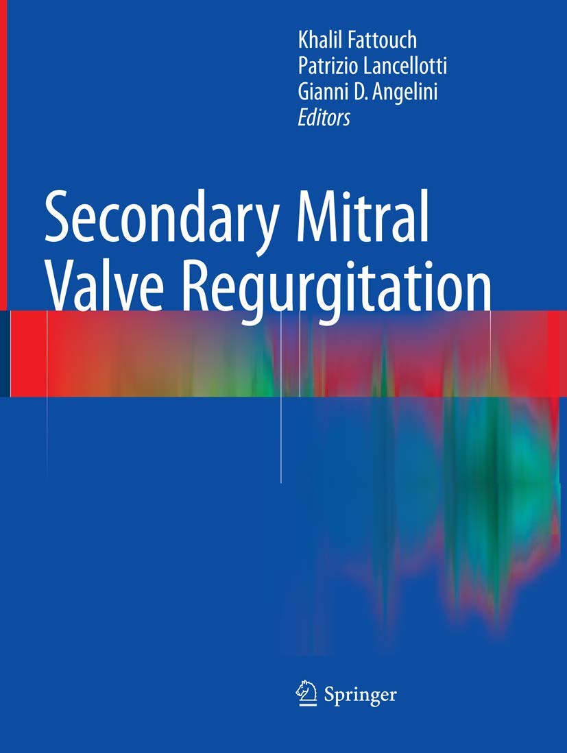 Secondary Mitral Valve Regurgitation: Causes and Treatment Options