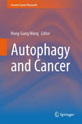 Autophagy and Cancer: Current Insights in Cancer Research