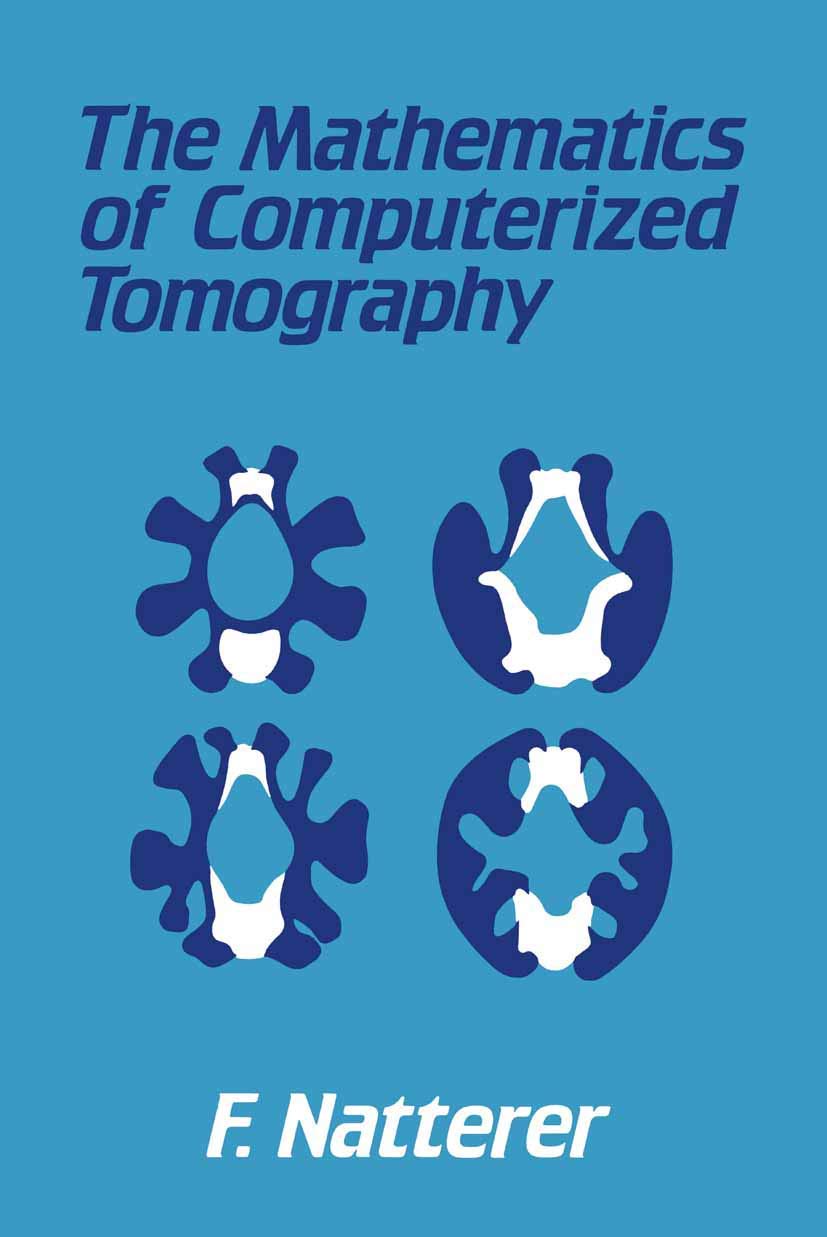 The Mathematics of Computerized Tomography: A Comprehensive Guide