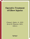 Operative Treatment of Elbow Injuries - Surgical Approaches