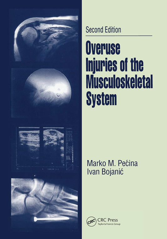 Overuse Injuries of the Musculoskeletal System: A Comprehensive Guide