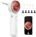 ScopeAround Otoscope with Light and 1.85in IPS Screen - Clear Home Ear