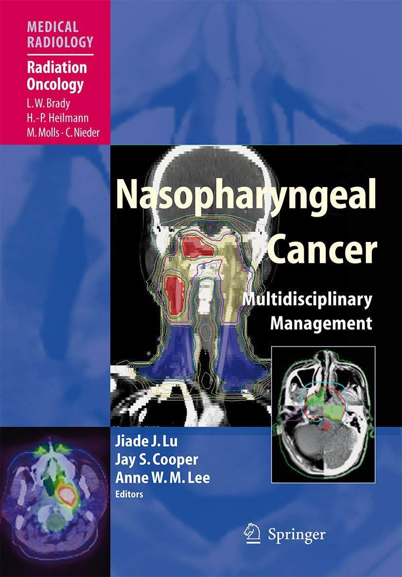 Nasopharyngeal Cancer Multidisciplinary Management Guidebook
