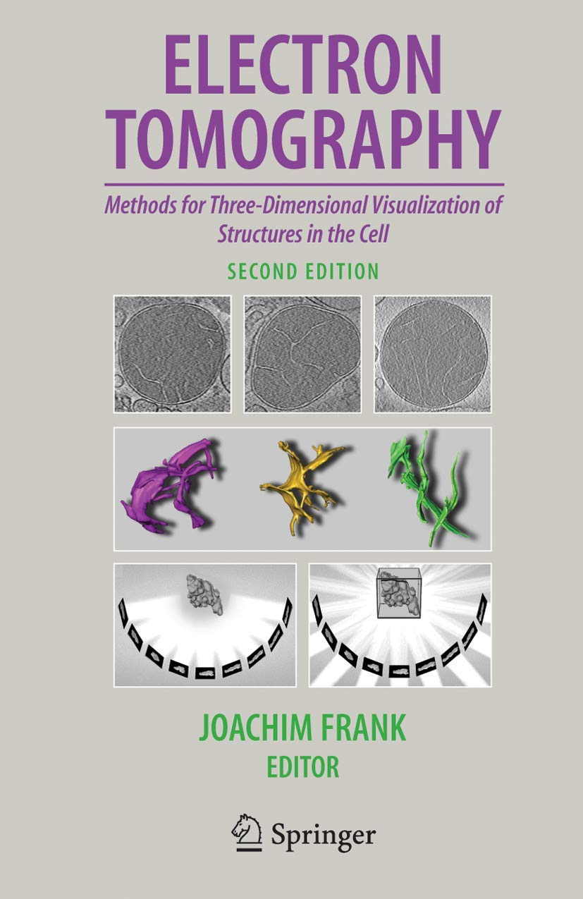 Electron Tomography: Methods for 3D Visualization of Cell Structures
