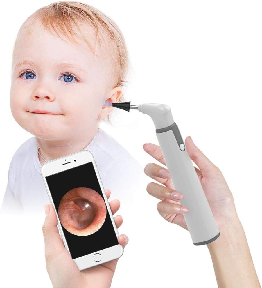 Wireless Otoscope with 720P HD Camera for Ear Wax Removal