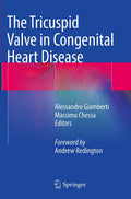 The Tricuspid Valve in Congenital Heart Disease: A Comprehensive Guide
