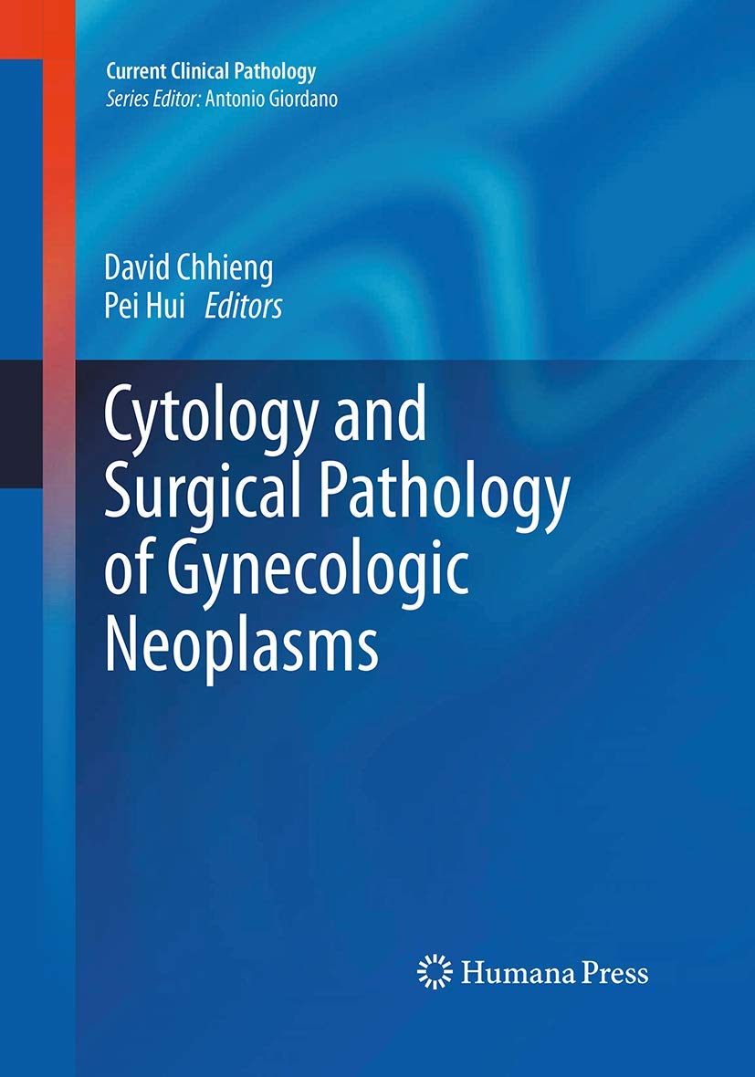 Cytology and Surgical Pathology of Gynecologic Neoplasms Review