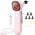 ScopeAround Digital Otoscope with IPS Screen - Easy On-the-Spot Ear