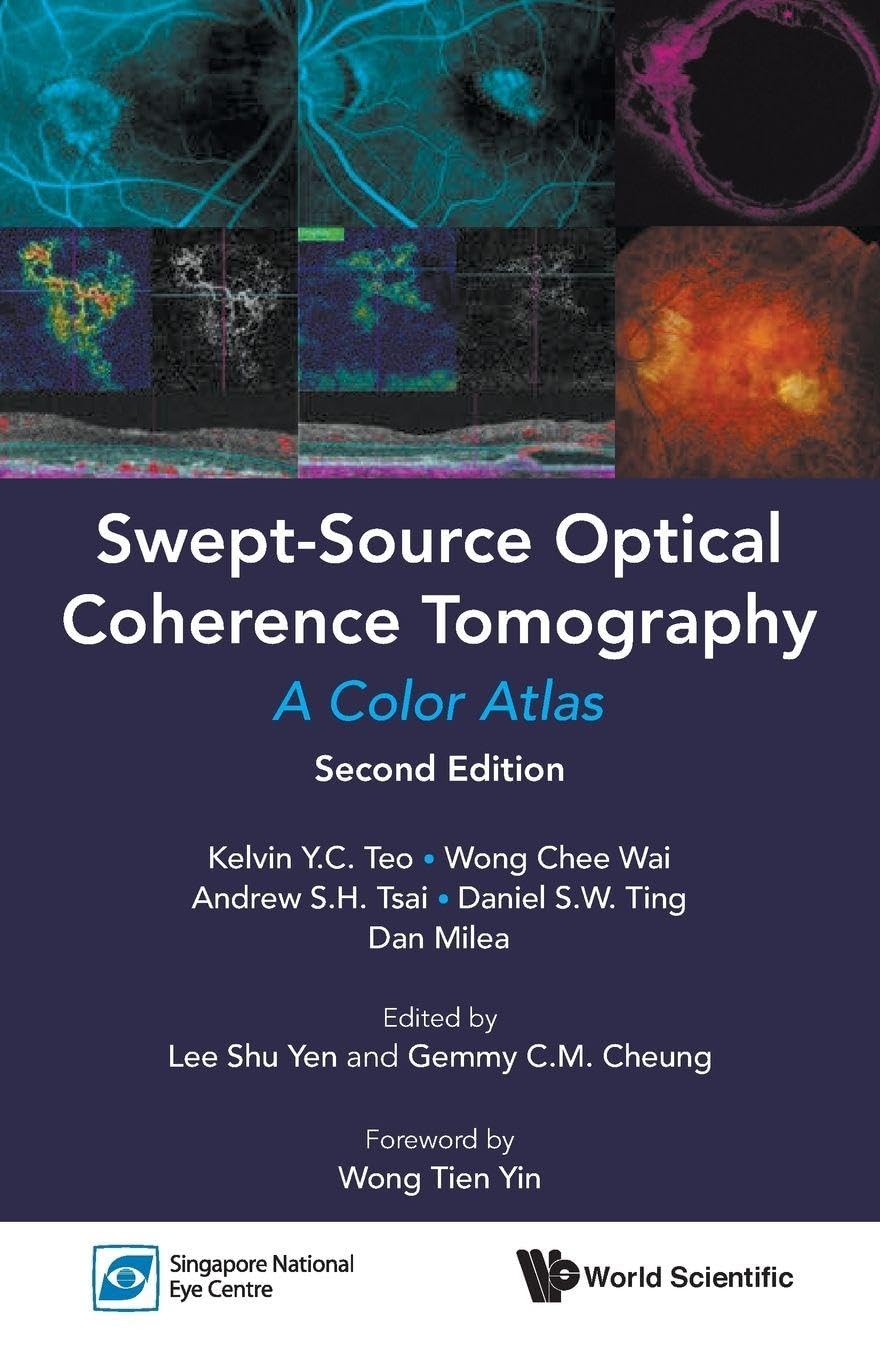 Swept-Source Optical Coherence Tomography Color Atlas Review