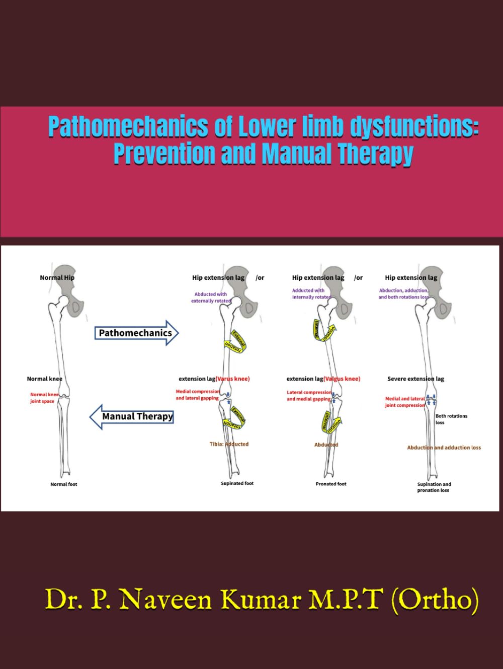 Lower Limb Dysfunction Prevention and Manual Therapy Guide