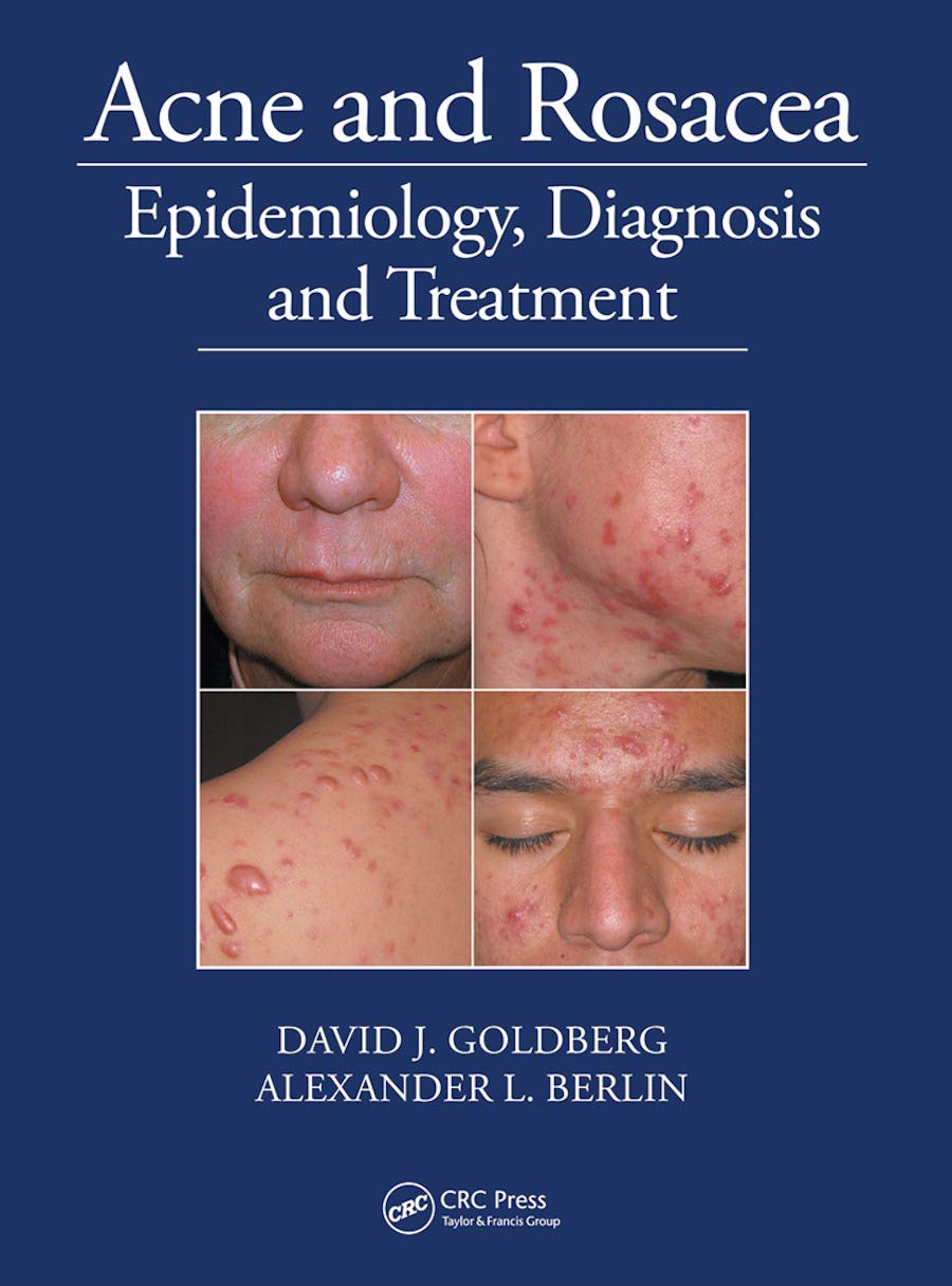 Acne and Rosacea Treatment for Clearer Skin by David Goldberg