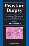 Prostate Biopsy: Indications, Techniques, and Complications - Clinical