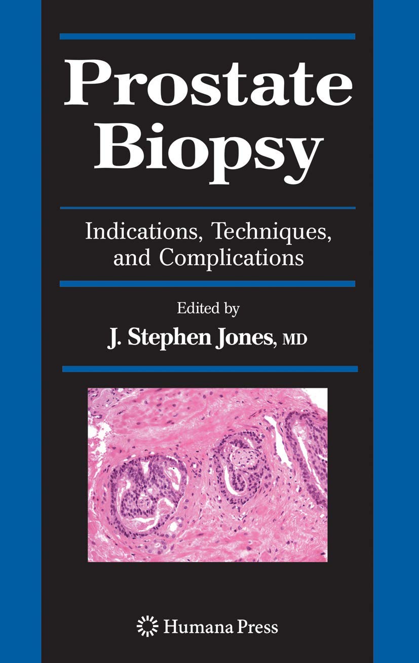 Prostate Biopsy: Indications, Techniques, and Complications Guide