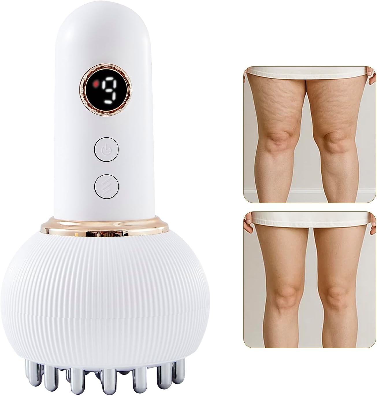 Yuonry Lymphatic Drainage Massager for Cellulite Reduction