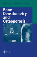 Bone Densitometry and Osteoporosis: Essential Insights for Health