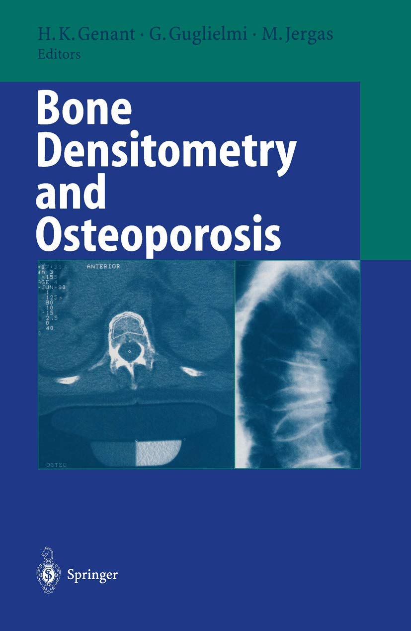 Bone Densitometry and Osteoporosis: Essential Insights for Health