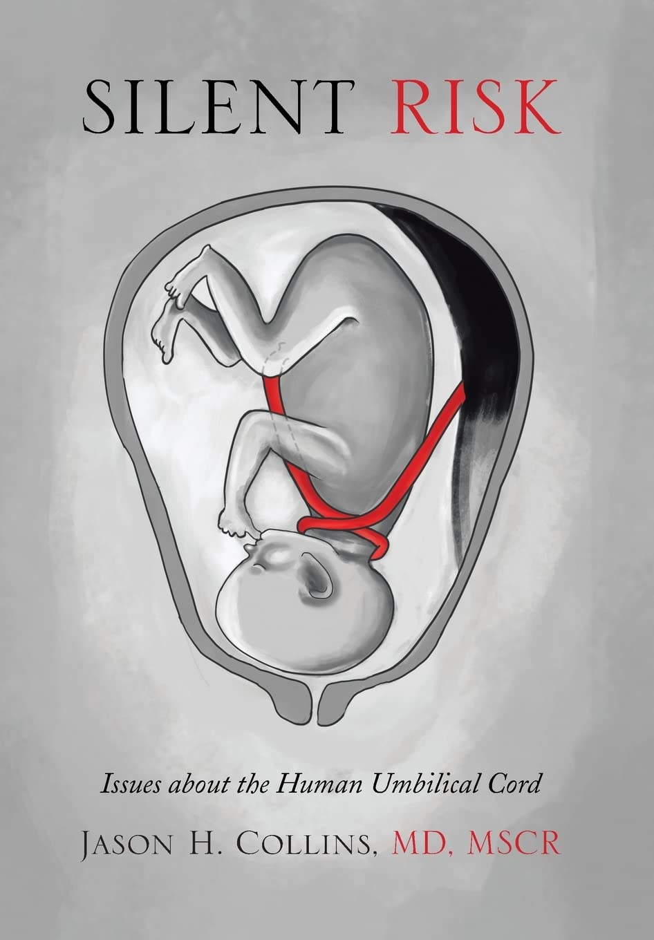 Silent Risk: Issues about the Human Umbilical Cord by Jason H. Collins