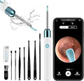 Ear Wax Removal Camera Otoscope with 1080P - Portable Ear Cleaner Kit