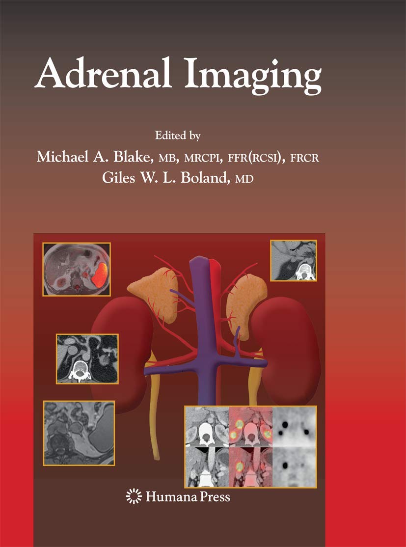 Adrenal Imaging Techniques for Enhanced Diagnostic Accuracy