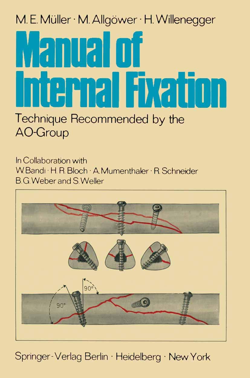 Manual of Internal Fixation Techniques by AO-Group Swiss Association