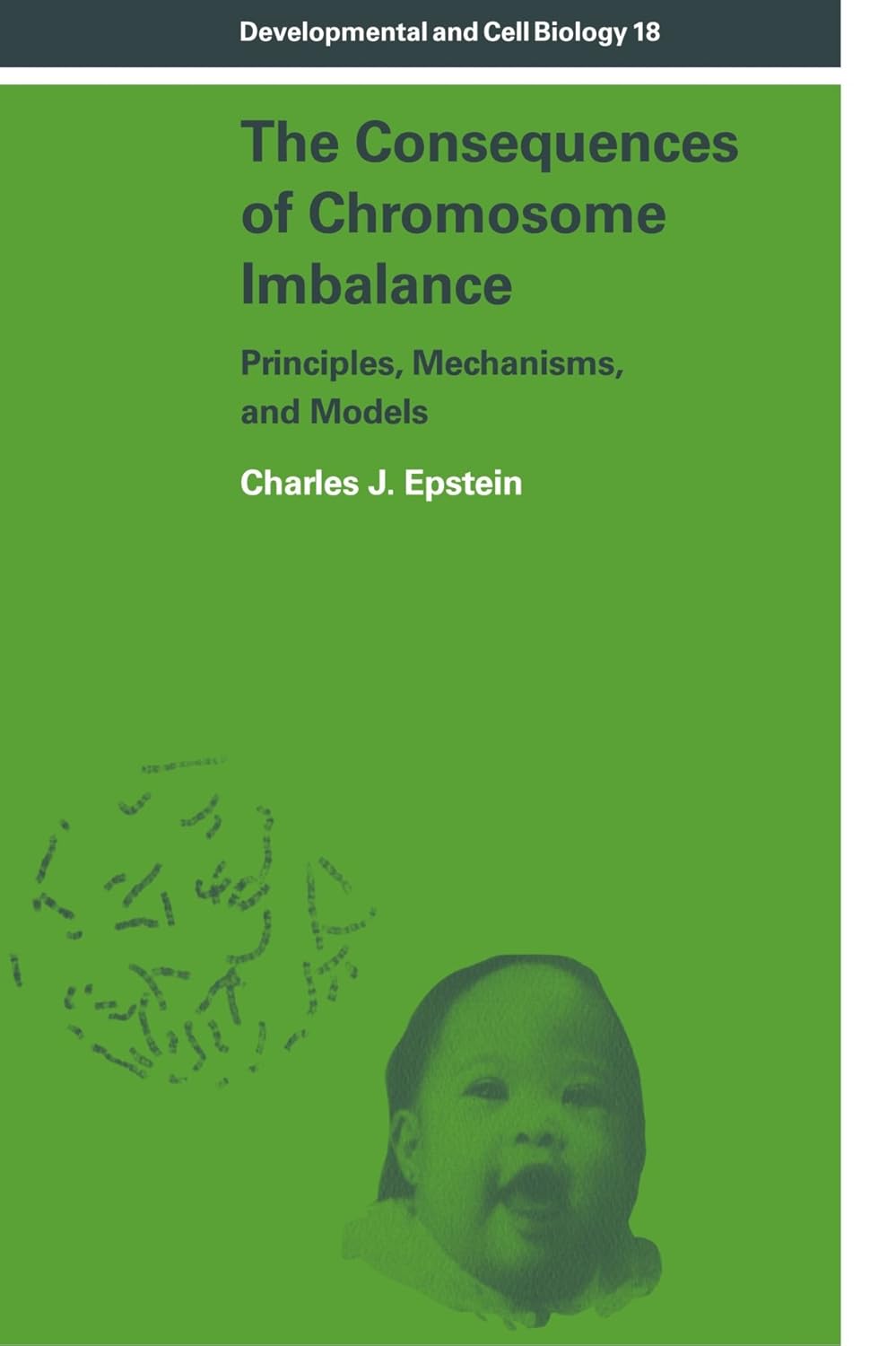 The Consequences of Chromosome Imbalance: Principles and Mechanisms