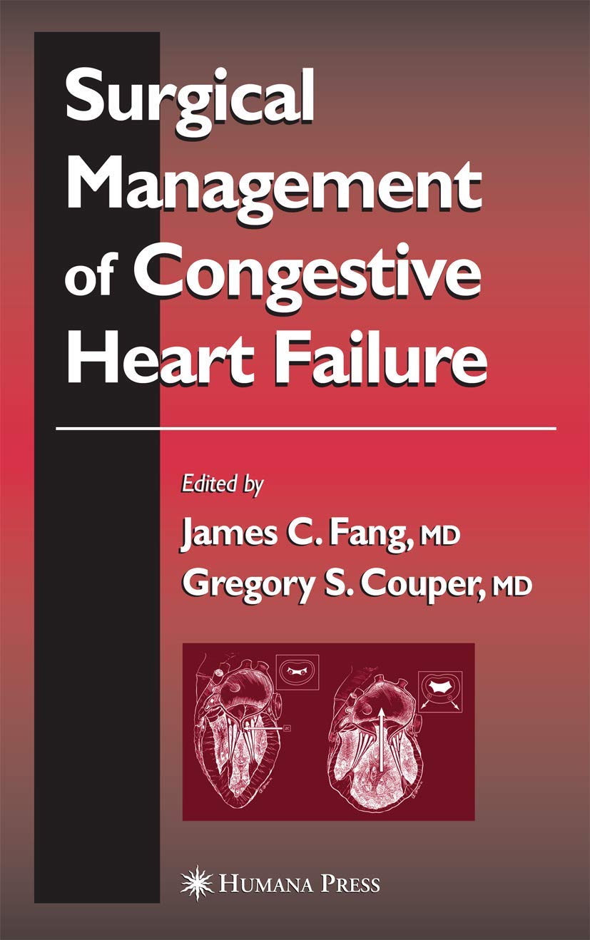 Surgical Management of Congestive Heart Failure: A Comprehensive Guide