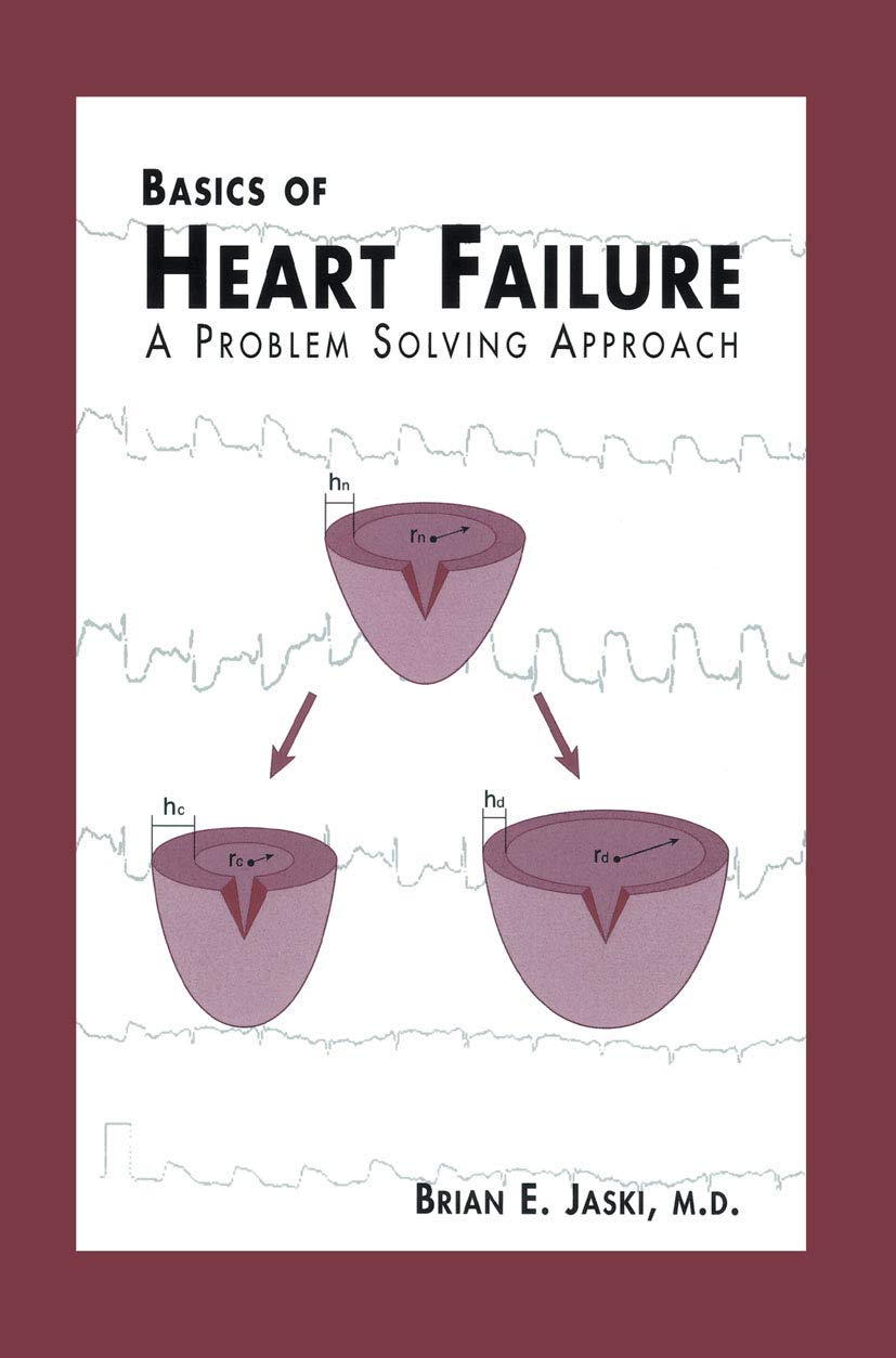 Basics of Heart Failure: A Problem Solving Approach Review