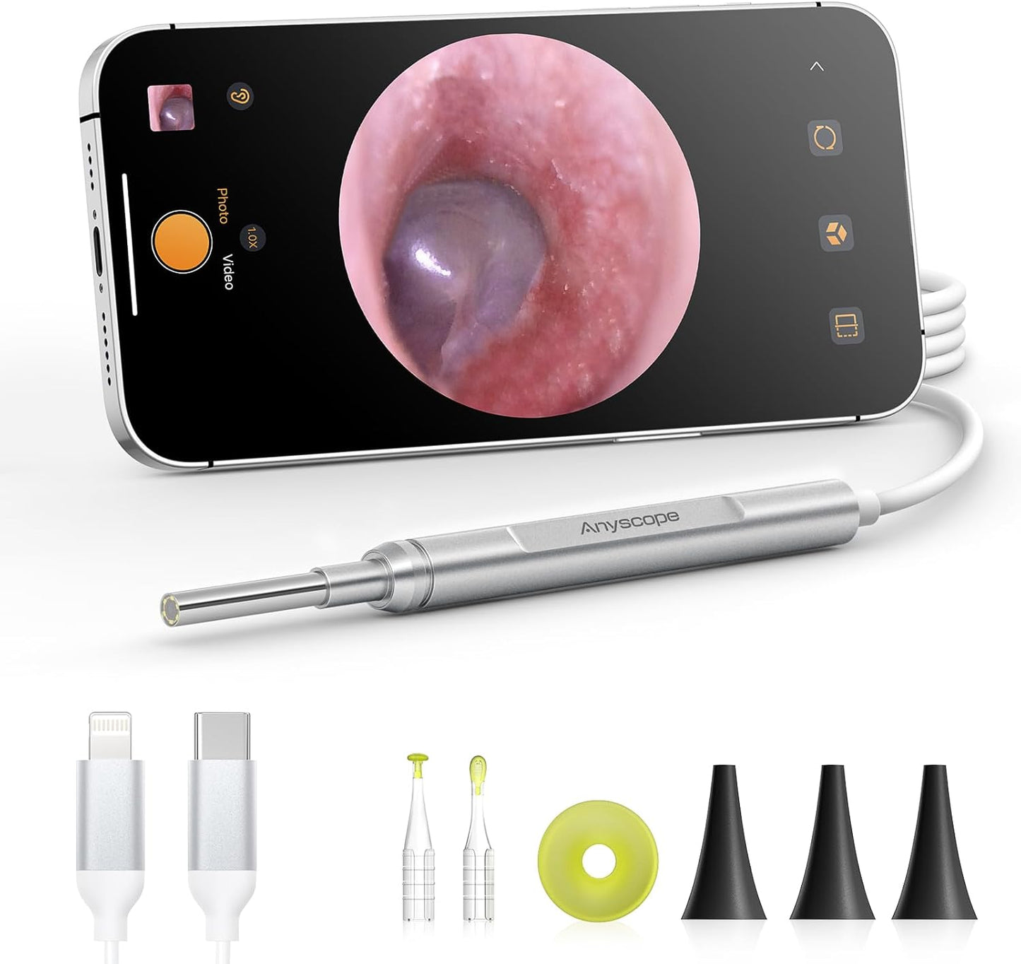 Digital Otoscope for iPhone and Android - HD Ear Camera Tool