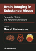 Brain Imaging in Substance Abuse: Research, Clinical, and Forensic
