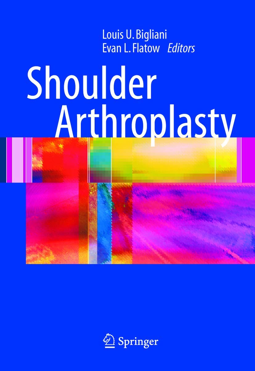 Shoulder Arthroplasty: Comprehensive Guide to Joint Replacement