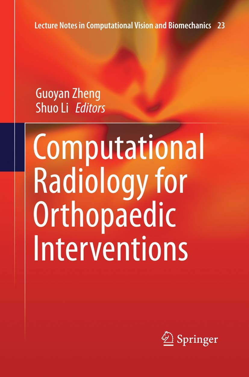 Computational Radiology for Orthopaedic Interventions Review