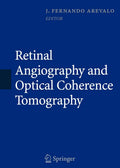 Retinal Angiography and Optical Coherence Tomography - Practical