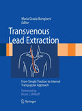 Transvenous Lead Extraction: From Simple Traction to Internal