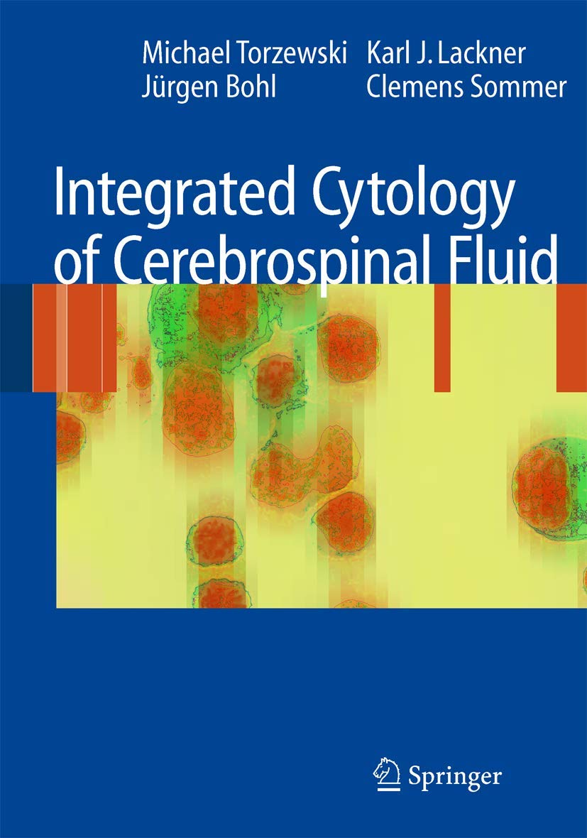 Integrated Cytology of Cerebrospinal Fluid for Accurate Diagnosis