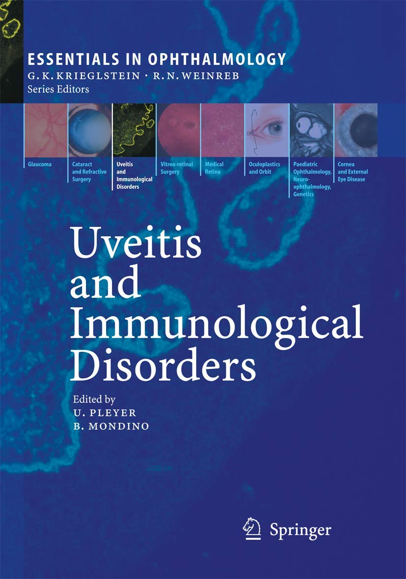 Uveitis and Immunological Disorders: Key Insights for Eye Care