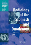 Radiology of the Stomach and Duodenum by Kottekattu Balan