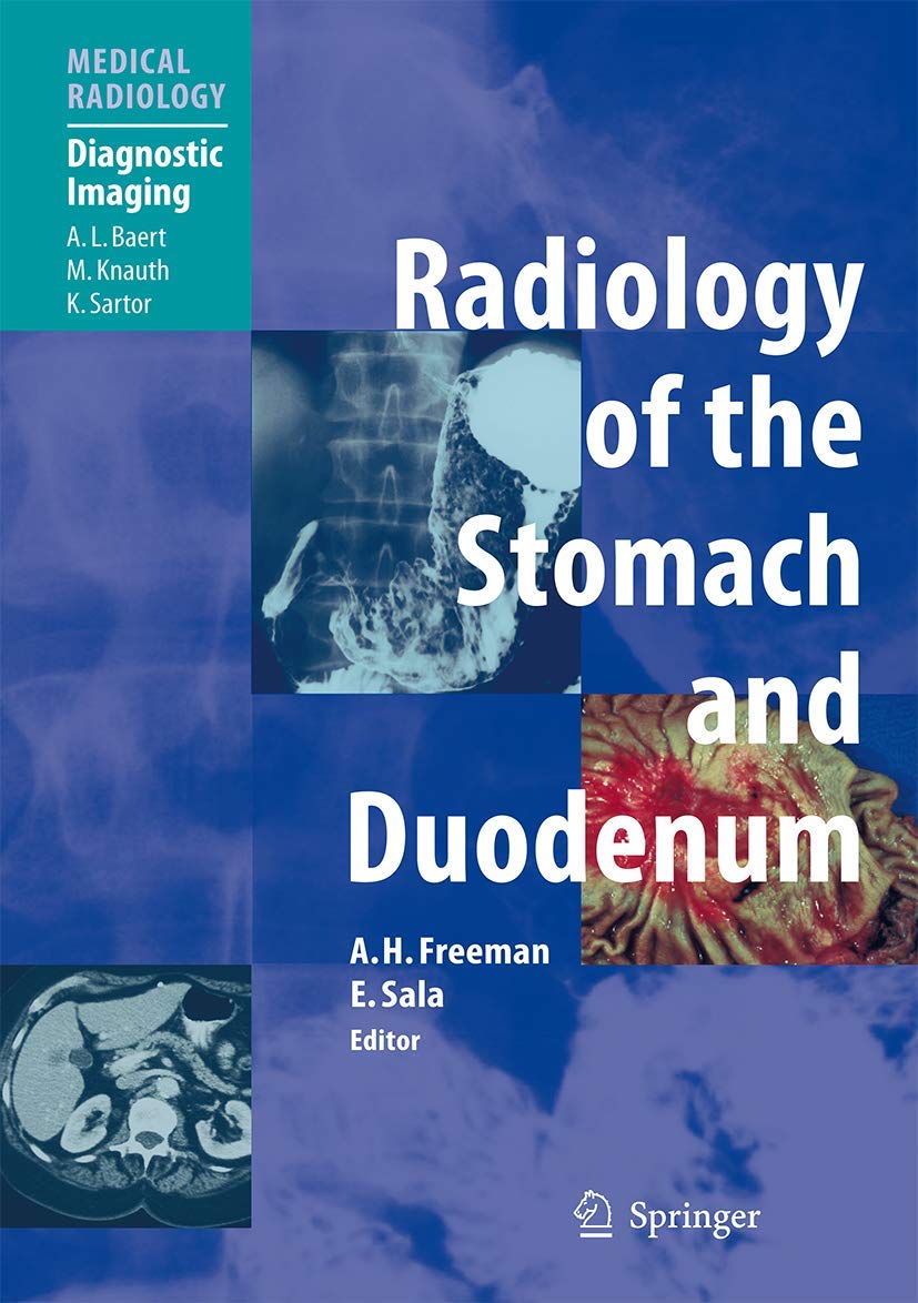 Radiology of the Stomach and Duodenum by Kottekattu Balan
