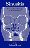 Sinusitis (Infectious Disease and Therapy, 35) - Practical Clinical
